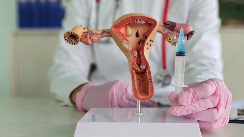 Rejuvenecimiento ovárico: tratamiento que da esperanza a mujeres con infertilidad por la edad