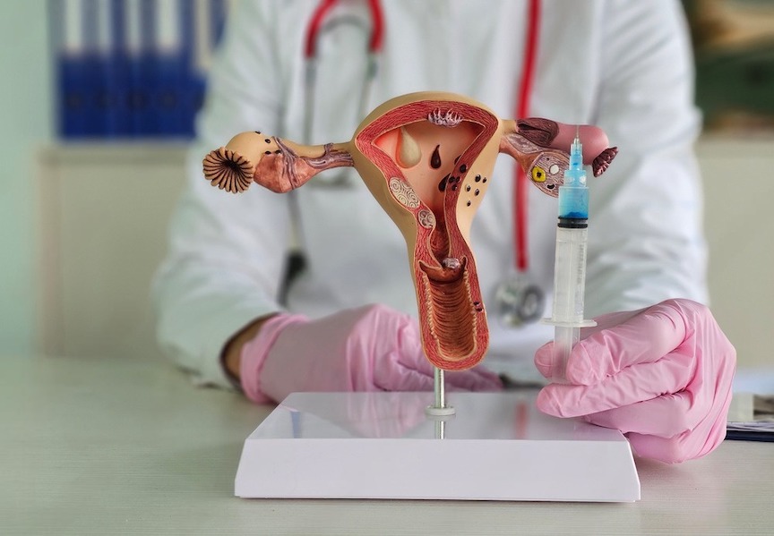 Rejuvenecimiento ovárico: tratamiento que da esperanza a mujeres con infertilidad por la edad